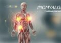 inomyalgia